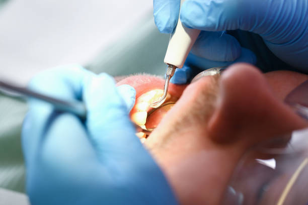 Best Emergency Root Canal Therapy in Clinton, IA