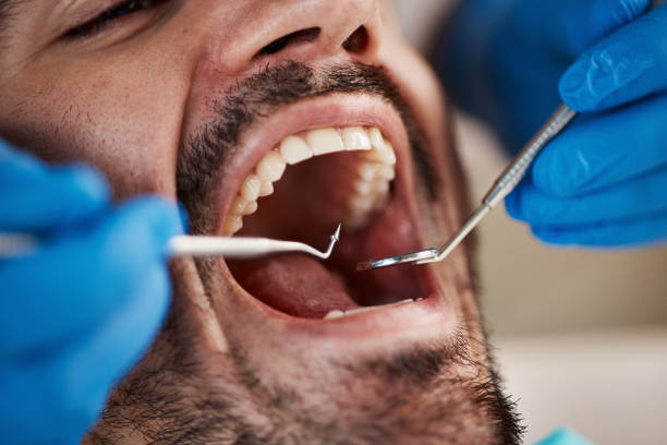Best Weekend Emergency Dental Services in Clinton, IA